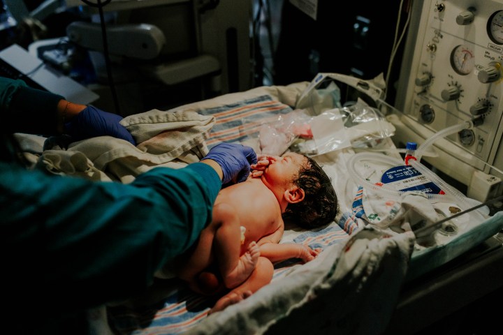 Chicago hospital birth photographer | Gabriel’s Birth Story